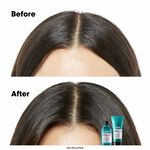 L'Or&eacute;al Professionnel Serie Expert Scalp Advanced Anti-Discomfort Dermo Regulator Shampoo 300ml
