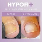 The Gel Bottle Inc. Hypofix Repair 7ml