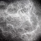 Dry Shampoo