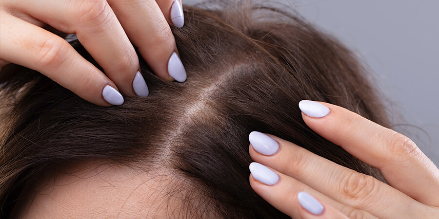 Hair loss and menopause: how to help your clients Hair loss and menopause: how to help your clients